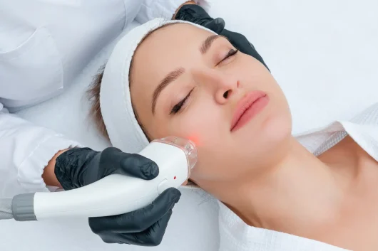 Laser Treatment